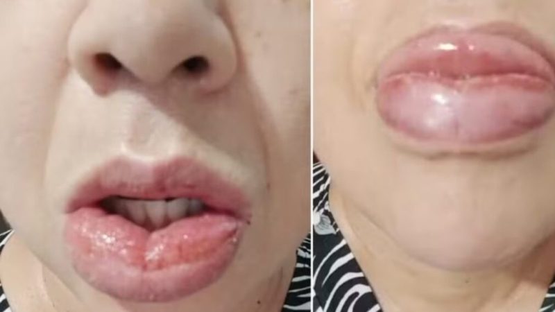 La Colgate Palmolive en Brasil dejará de fabricar una de su pasta de dientes tras denuncias de lesiones orales, ardor, escozor en inflamación en consumidores