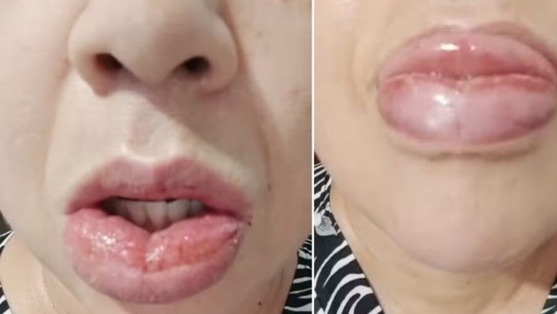 La Colgate Palmolive en Brasil dejará de fabricar una de su pasta de dientes tras denuncias de lesiones orales, ardor, escozor en inflamación en consumidores